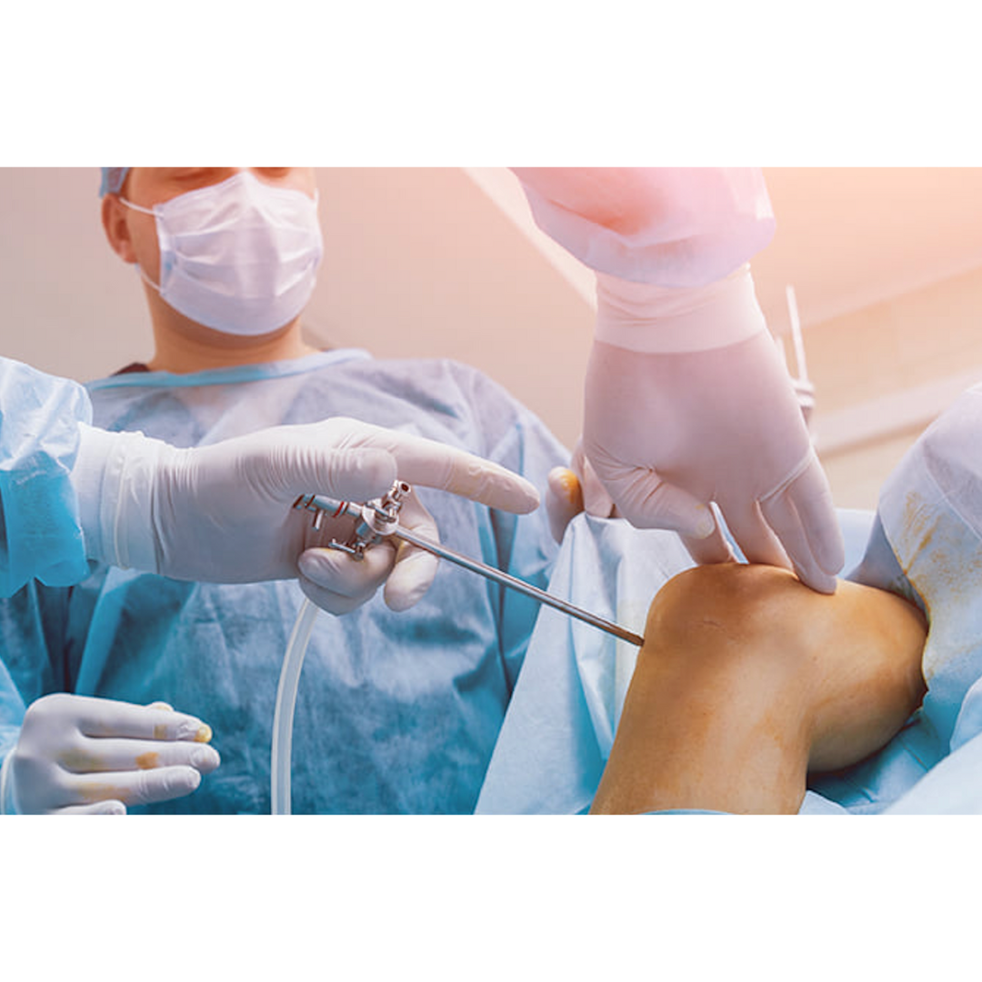 Arthroscopic Surgery