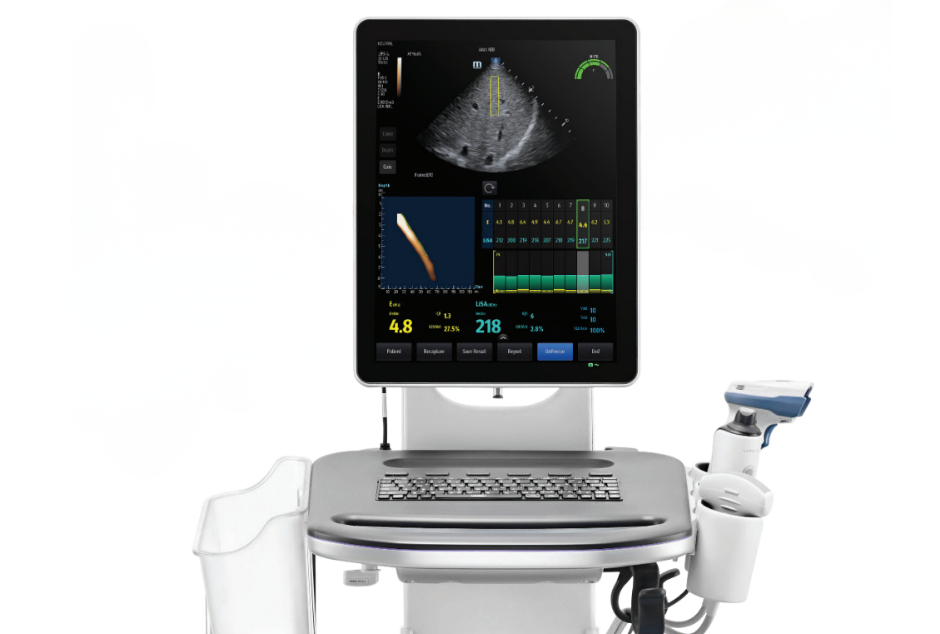 Mindray Hepatus 6 Vibration Controlled Transient Elastography (VCTE)